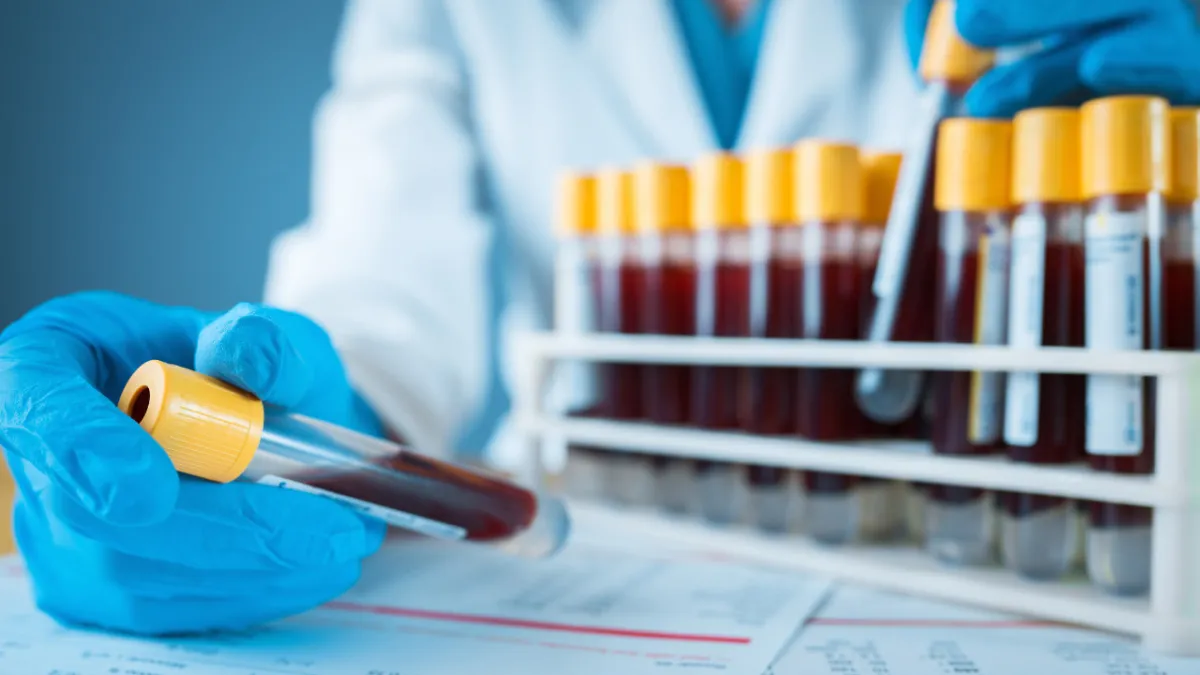 Kolon kanseri taraması için geliştirilen kan testine FDA'dan onay
